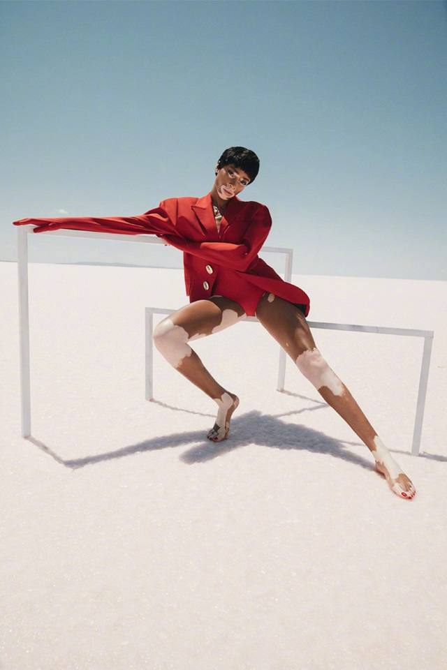 Winnie Harlow @ ELLE Turkey July 2018