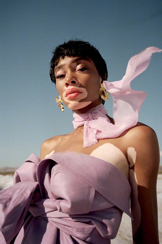 Winnie Harlow @ ELLE Turkey July 2018