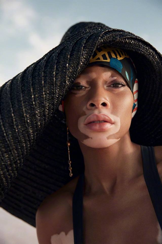 Winnie Harlow @ ELLE Turkey July 2018