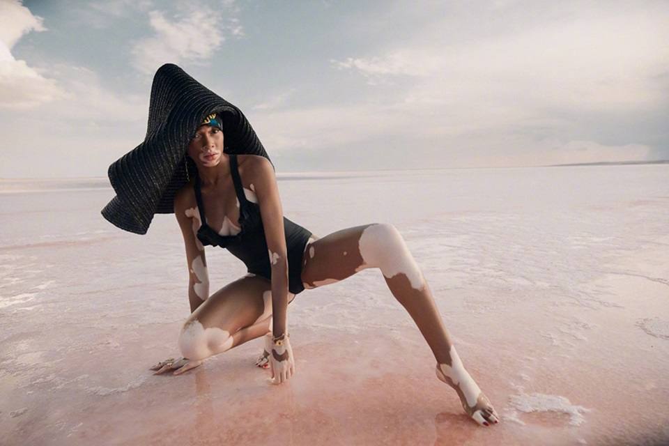 Winnie Harlow @ ELLE Turkey July 2018