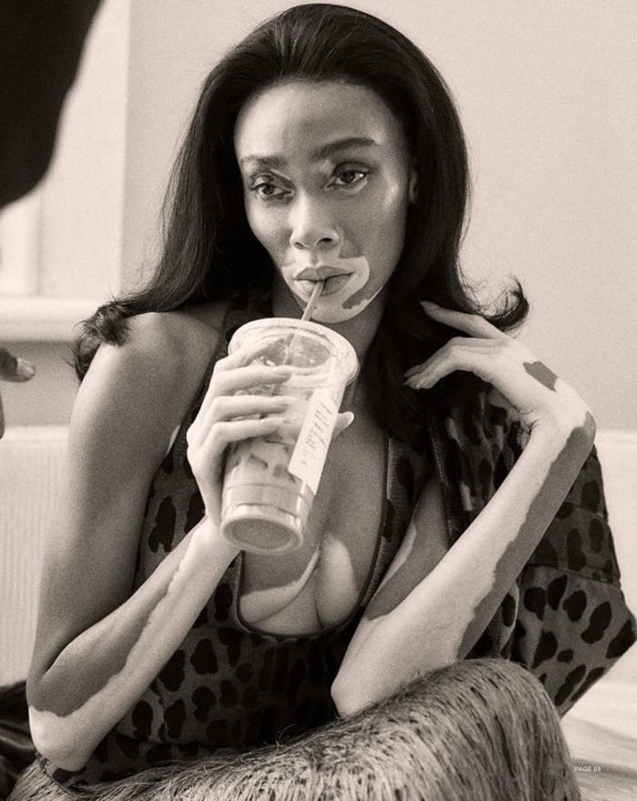 Winnie Harlow @ Harper's Bazaar Taiwan March 2019