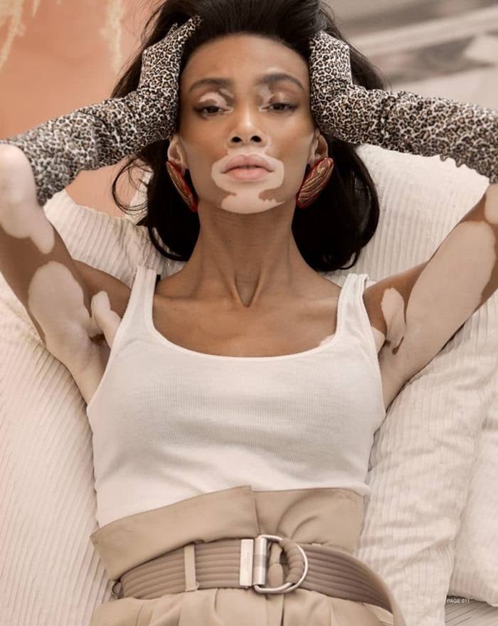 Winnie Harlow @ Harper's Bazaar Taiwan March 2019