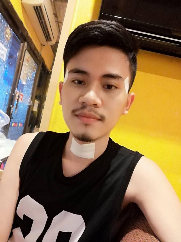 ยาเงาะ