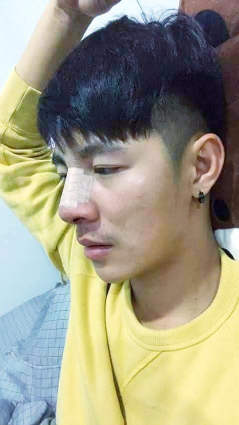 นายจะถอดเอง(หรือ)จะให้เราถลก