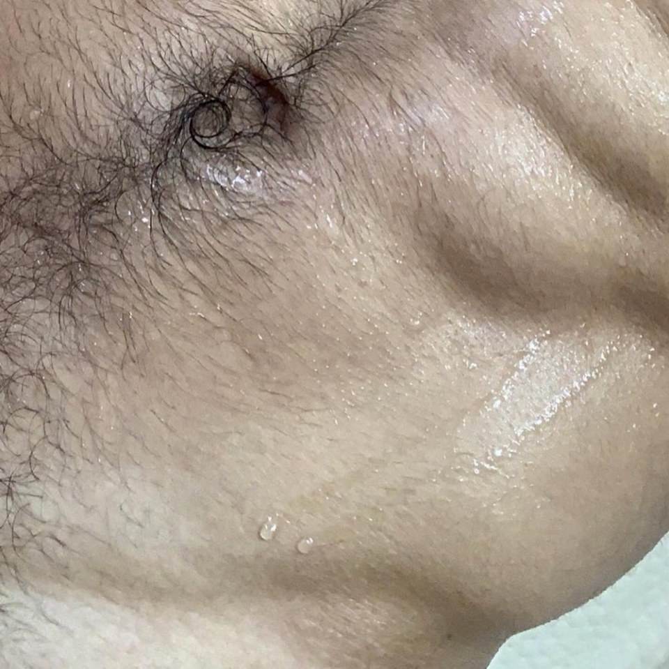 ขออีก ถอดบน ถอดล่าง