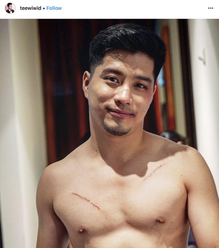 ผัว2ต้องร่าน