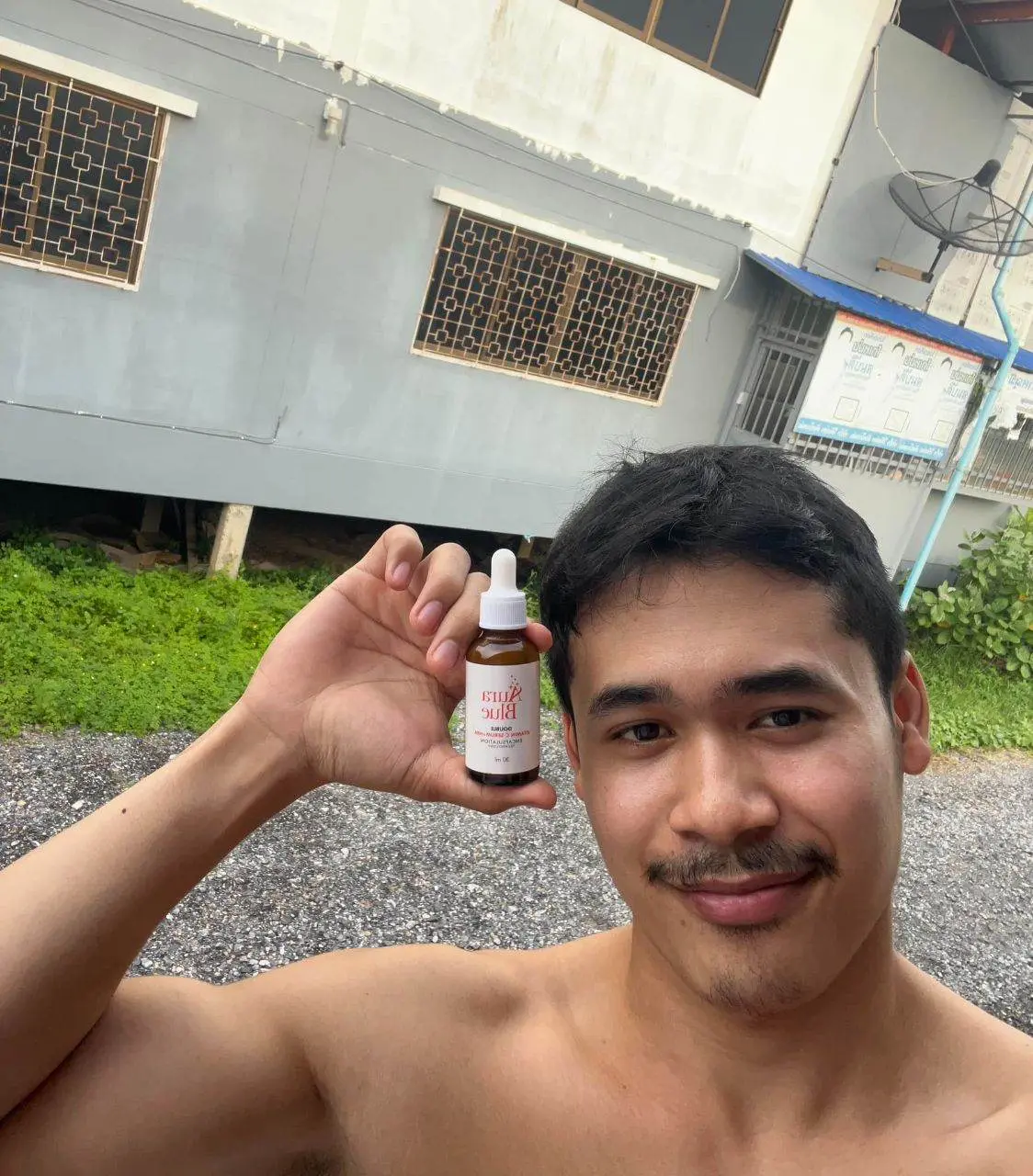 แพ้ตอหนวดไรหนวด